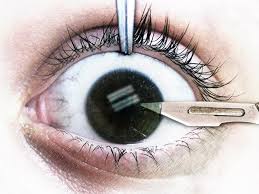 ojo-cirugía.jpg