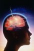 Treatment-for-Bipolar-bipolar-brain.jpg