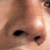 nariz.jpg