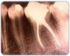 img_endodoncia.jpg